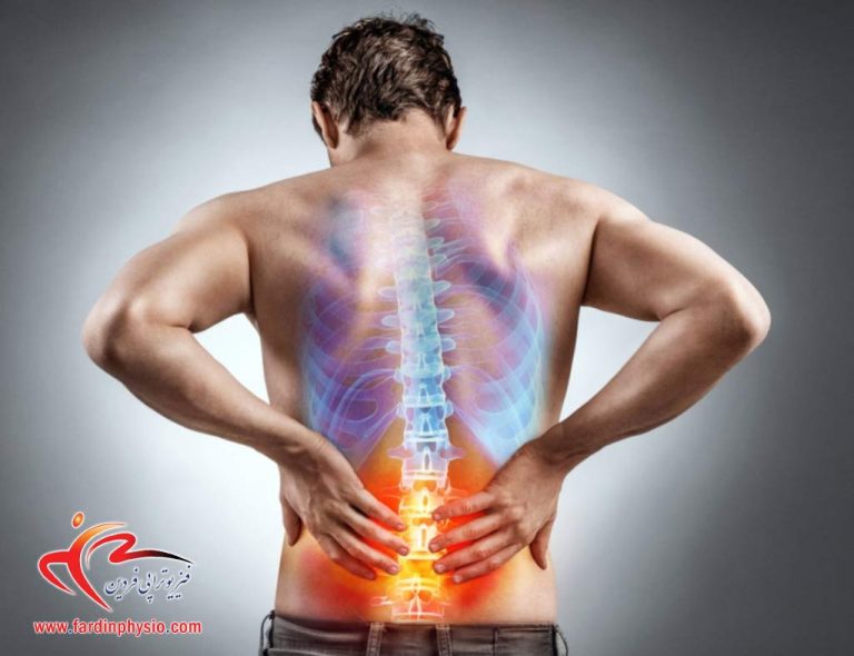 درباره این مقاله بیشتر بخوانید درمان دیسک کمر با فیزیوتراپی و بدون جراحی