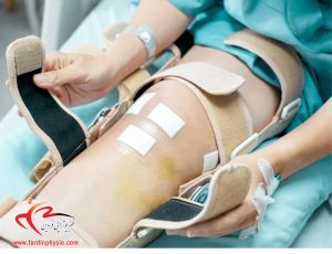 درباره این مقاله بیشتر بخوانید مراقبت‌های بعد از جراحی رباط صلیبی زانو چیست؟