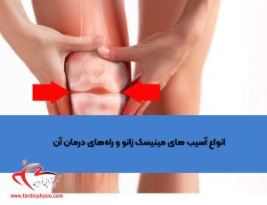 درباره این مقاله بیشتر بخوانید انواع آسیب های مینیسک زانو و راه‌های درمان آن
