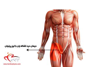 درباره این مقاله بیشتر بخوانید درمان درد کشاله ران با لیزر پرتوان: یک رویکرد نوین در فیزیوتراپی