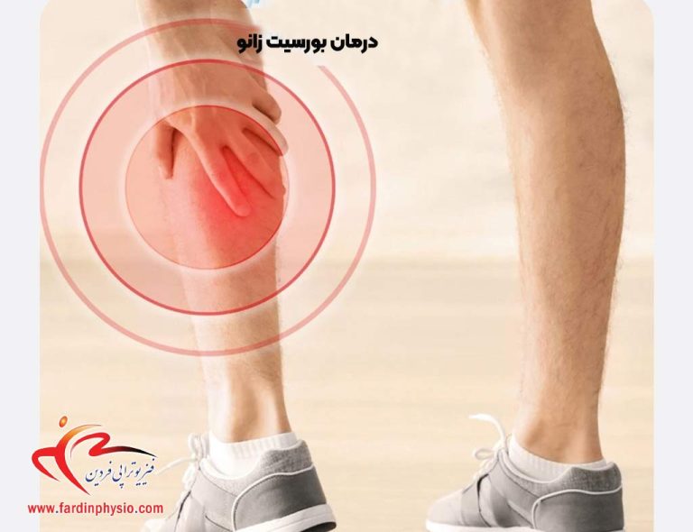 درباره این مقاله بیشتر بخوانید فیزیوتراپی بورسیت زانو: مدیریت و بازتوانی