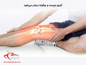 درباره این مقاله بیشتر بخوانید آرتروز چیست و چگونه درمان می‌شود