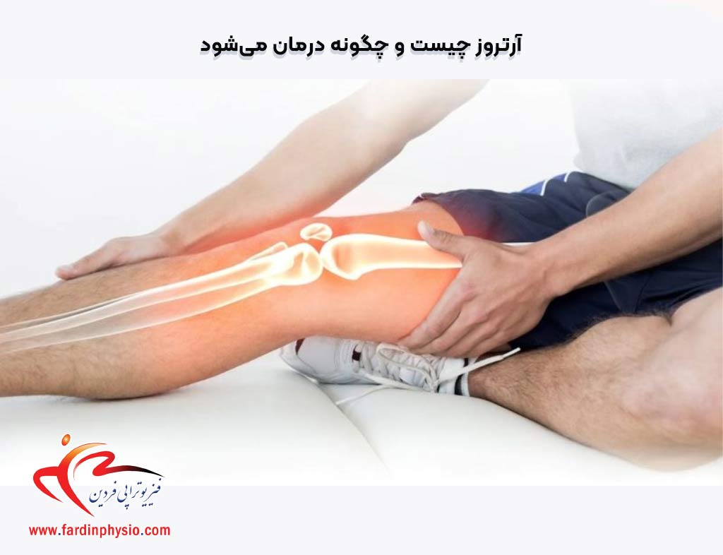 You are currently viewing آرتروز چیست و چگونه درمان می‌شود